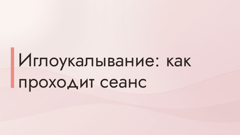 Иглоукалывание: как проходит сеанс
