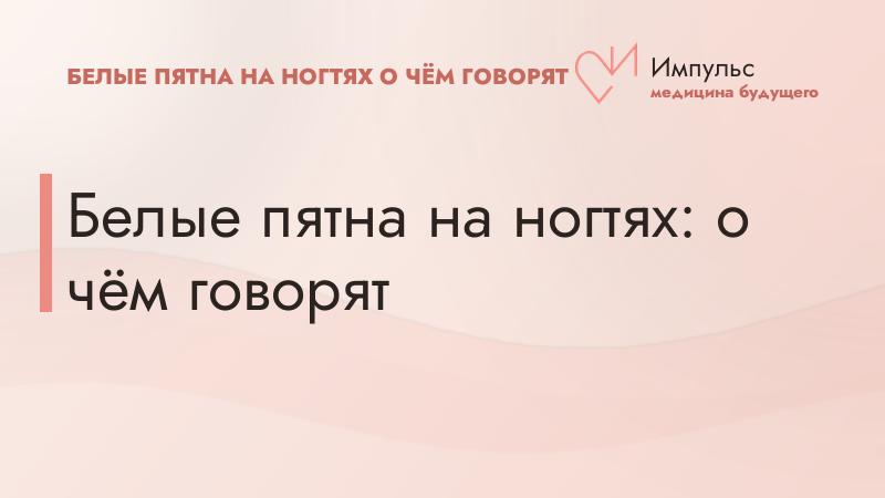 Белые пятна на ногтях: о чём говорят