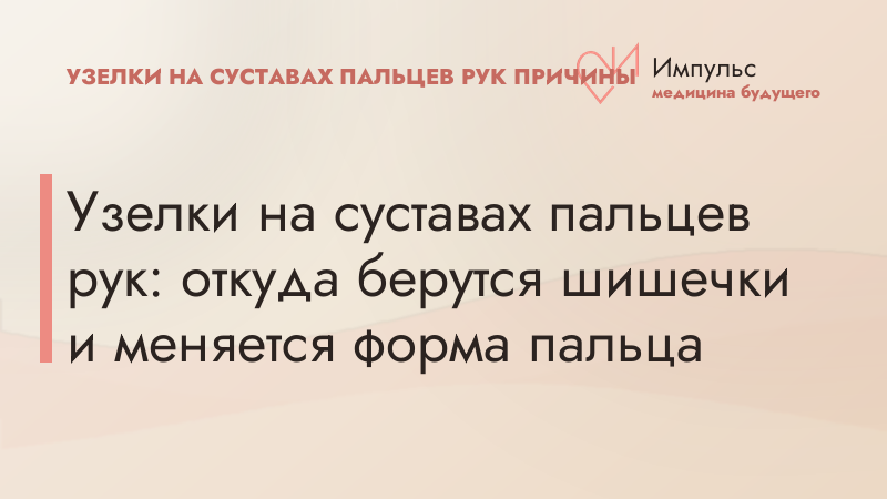 Узелки на суставах пальцев рук: откуда берутся шишечки и меняется форма пальца